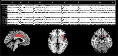 Sleep and brain evolution across the human lifespan: A mutual embrace